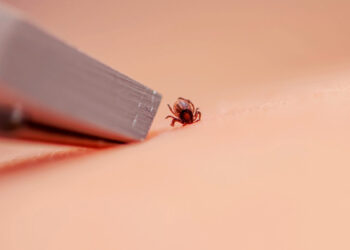 So, you got bit by a tick. Here’s exactly what to do next.