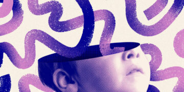 Brain scans reveal 3 ADHD subtypes, including a more extreme form