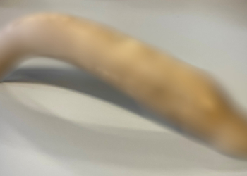 Museum Finds 8-Inch Ancient Roman Bone Penis in Unopened Box