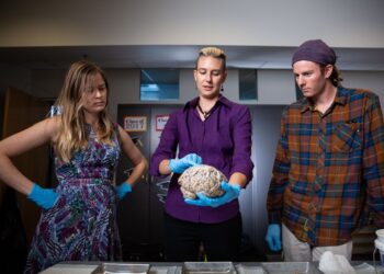 Surprising links between autism, Alzheimer’s could change how we treat both