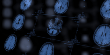 This ‘Healthy’ Ingredient You’re Probably Eating Might Give You a Stroke