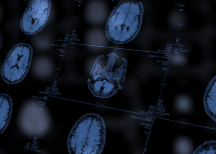 This ‘Healthy’ Ingredient You’re Probably Eating Might Give You a Stroke