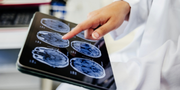 Your Brain May Not Experience Free Will the Way You Think