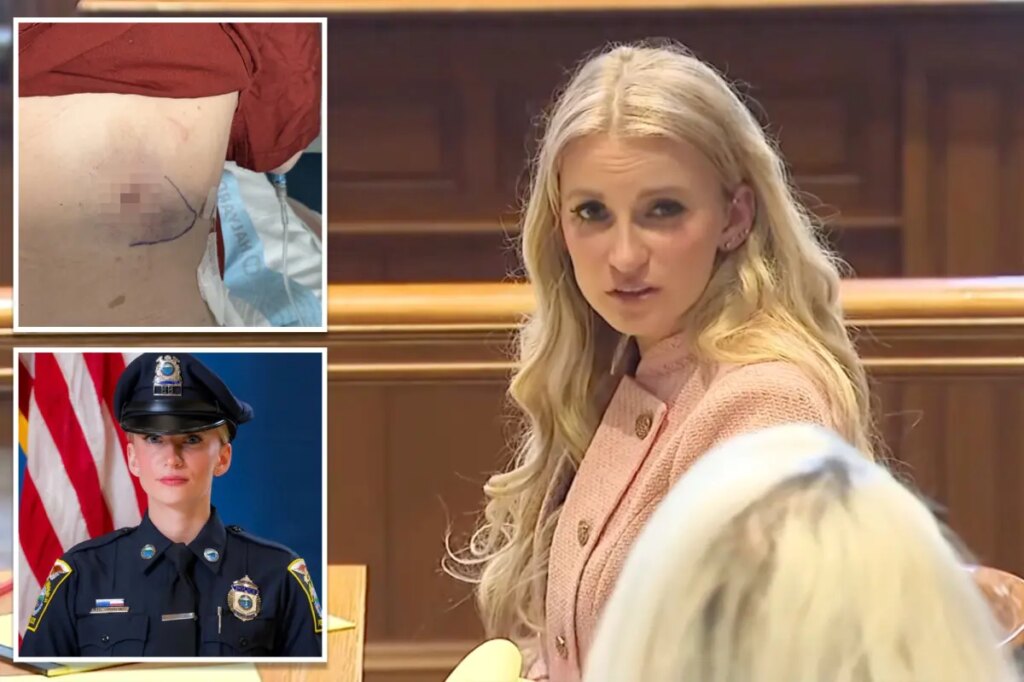 Cop Kelsey Fitzsimmons shares graphic image of where she was shot by fellow officer as she plans lawsuit against town