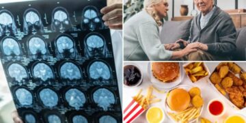 Dementia risk rises with common food type millions eat every day, study suggests
