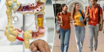 Concerning rise in colon cancer deaths is almost entirely among key demographic