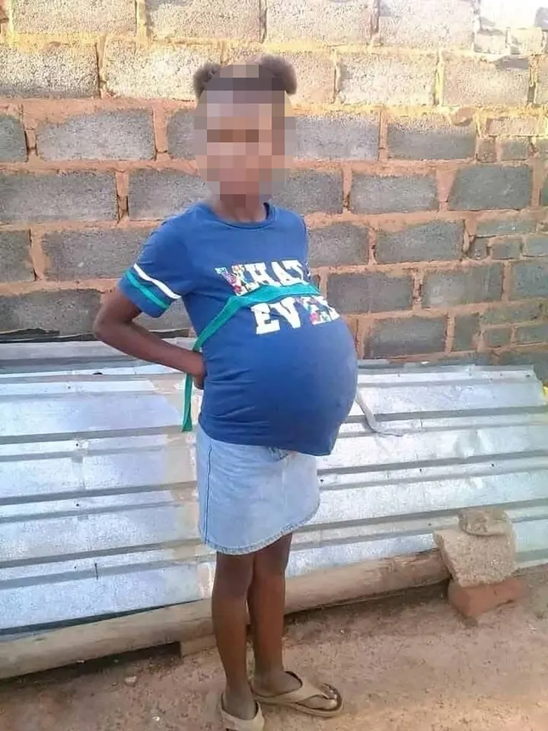 A 10-year-old girl from Soweto, South Africa, stands with a distended abdomen, suggesting pregnancy.