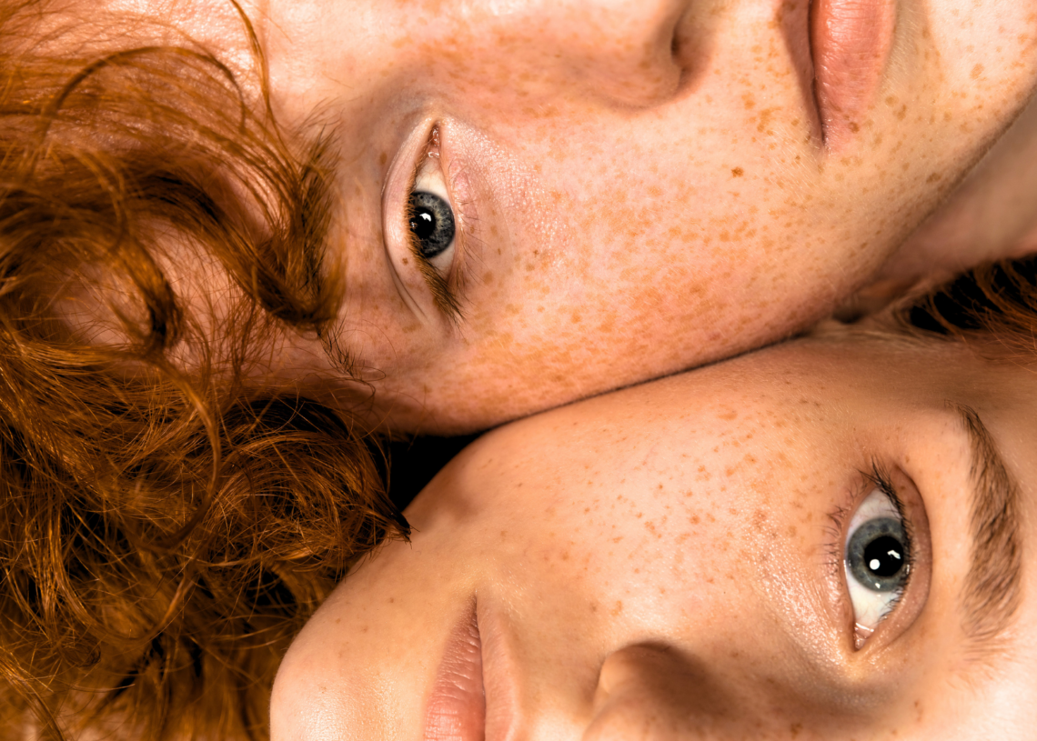 There Are More Redheads Than Ever Thanks to an Unexpected Evolutionary Twist