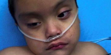 Disabled 4-year-old boy found face down in SoCal elementary school pool. Mother sues district