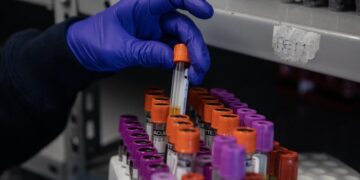 A sex test for Olympic contenders harms all women