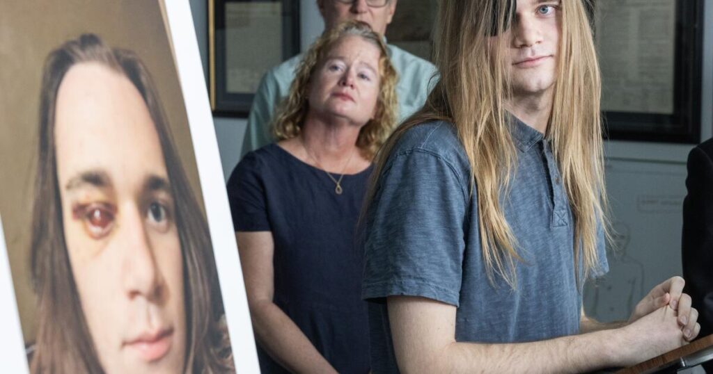 An immigration agent shot out his eye at a ‘No Kings’ rally. His lawyers plan to file claim against Homeland Security