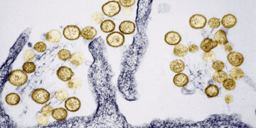 What Is Hantavirus, Which Is Linked to the Deaths of 3 People Aboard a Cruise Ship?