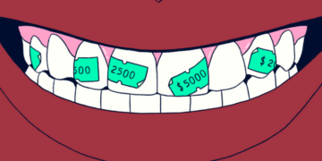 A Cavity Doesn’t Always Need a Filling