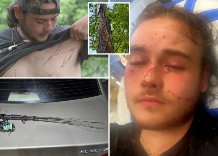 Fisherman survives lightning strike that left him covered in burns: ‘Unluckiest lucky man alive’