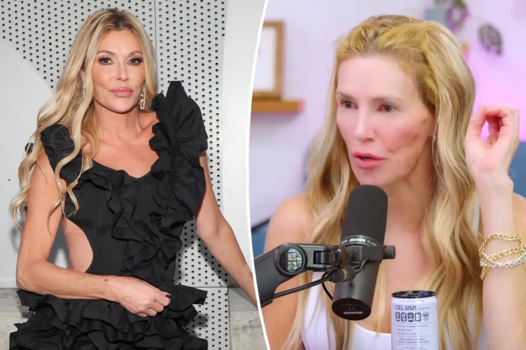 Brandi Glanville thinks she has a ‘sexually transmitted ringworm’ in her throat amid ongoing health issues