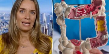 Doctors push new blood tests for colon cancer as cases surge in younger adults