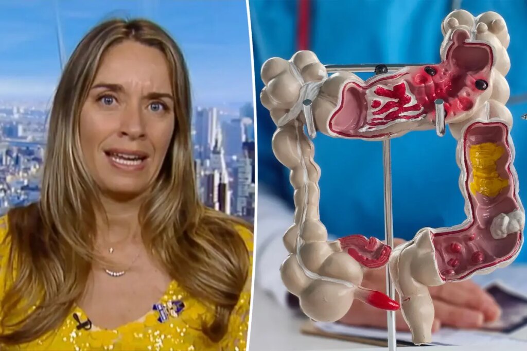 Doctors push new blood tests for colon cancer as cases surge in younger adults