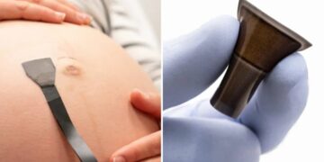 Wearable ultrasound patch can monitor high-risk pregnancies round the clock