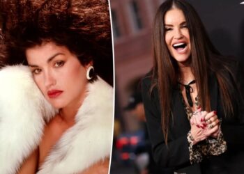 See supermodel Janice Dickinson before she underwent several cosmetic facial procedures