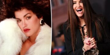 See supermodel Janice Dickinson before she underwent several cosmetic facial procedures