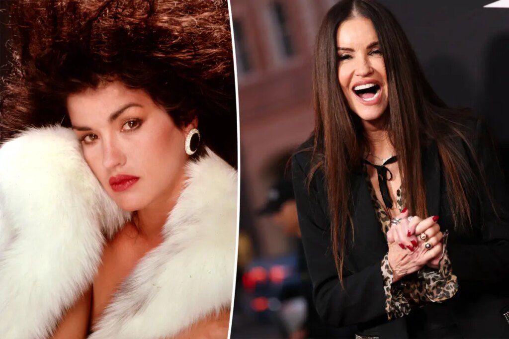 See supermodel Janice Dickinson before she underwent several cosmetic facial procedures