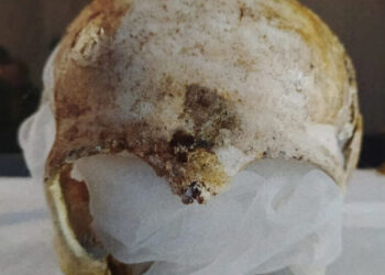 Man Stole Medieval Skull From Church and Sealed it in Concrete, Police Say