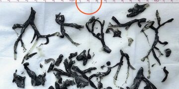 New England Journal of Medicine Retracts Paper Because Photo of Patient’s Insides Was Garbled by AI