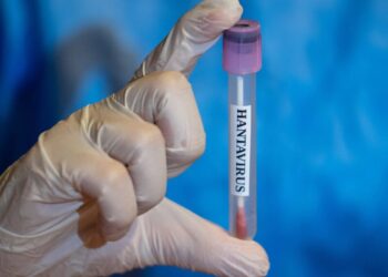 Several U.S. States Monitoring Cruise Passengers as Latest Hantavirus Case Reported