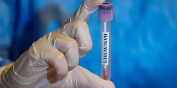 Several U.S. States Monitoring Cruise Passengers as Latest Hantavirus Case Reported