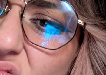Did You Share a Chin Close-Up? What to Know About Instagram Instants.