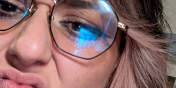 Did You Share a Chin Close-Up? What to Know About Instagram Instants.