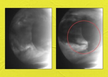 Scientists Detect Weird Anomalies in Clouds of Venus