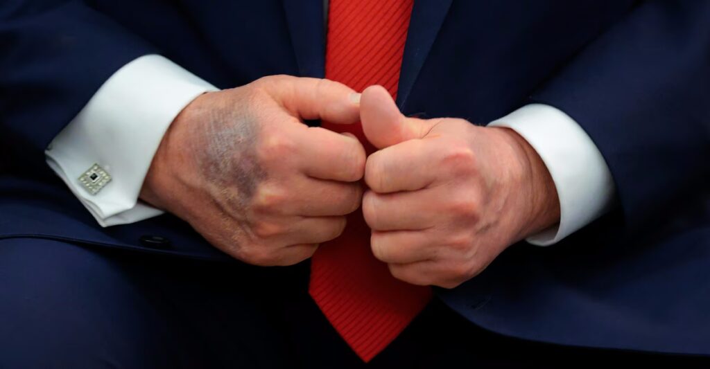 The Newest Oldest President