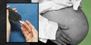 A Mystery About Diabetes in Pregnancy