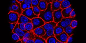 Experimental pill nearly doubles survival time for people with advanced pancreatic cancer. ‘I actually started crying’