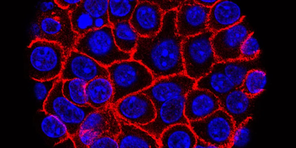 Experimental pill nearly doubles survival time for people with advanced pancreatic cancer. ‘I actually started crying’