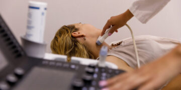These thyroid disorder symptoms are easy to mistake for normal aging