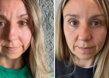 I get Botox as often as I can afford it. My aging face started to distract me on work calls — the cost is worth every penny.