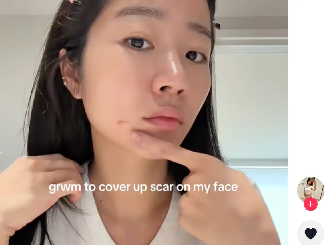 Evelyn Ha posting about her injuries