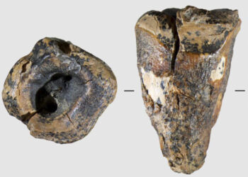 A Neanderthal with a cavity opened wide for a stone drill
