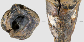 A Neanderthal with a cavity opened wide for a stone drill