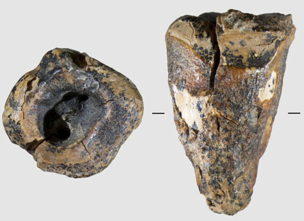 A Neanderthal with a cavity opened wide for a stone drill