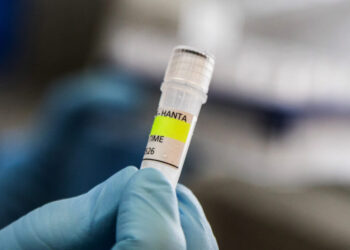 Why the quarantine for hantavirus is so long