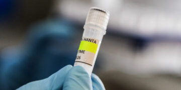 Why the quarantine for hantavirus is so long