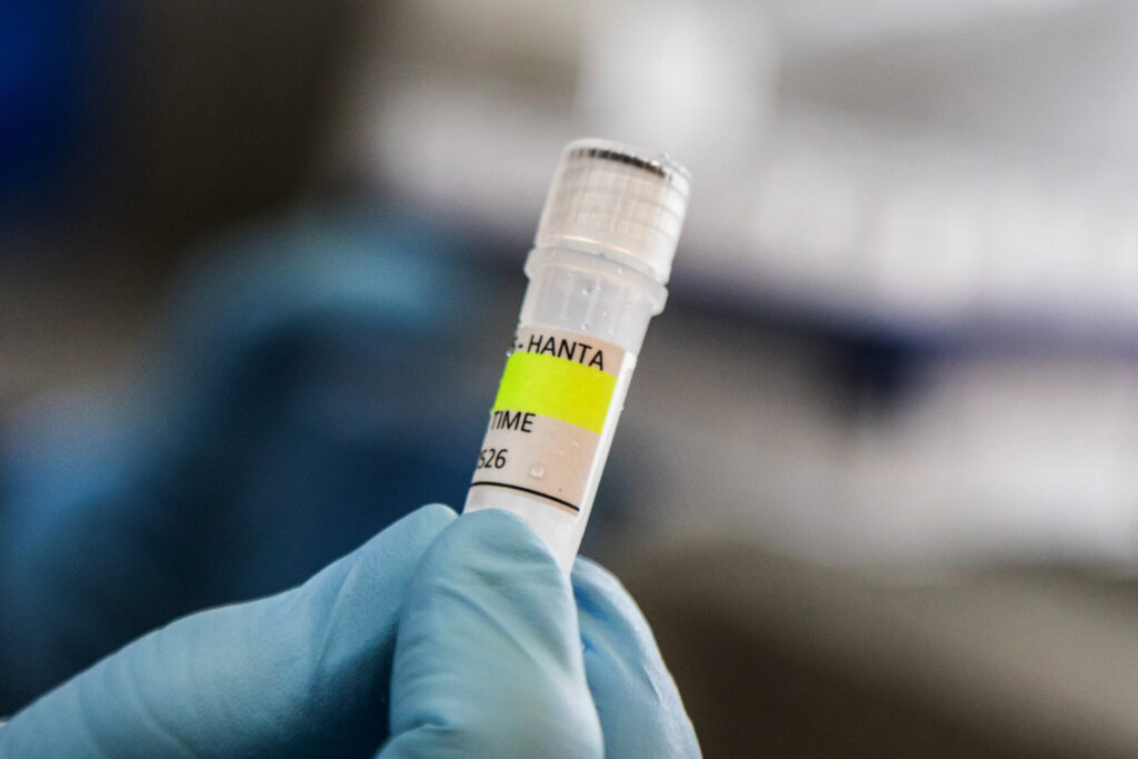 Why the quarantine for hantavirus is so long