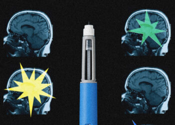 Ozempic may be reshaping the brain, scientists say