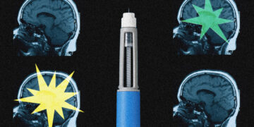 Ozempic may be reshaping the brain, scientists say