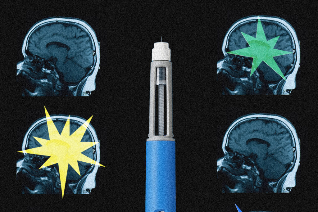 Ozempic may be reshaping the brain, scientists say
