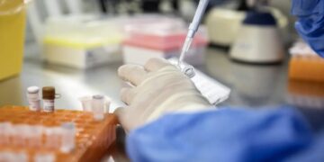 Supercharging Immune Cells May Help Control HIV Long-Term