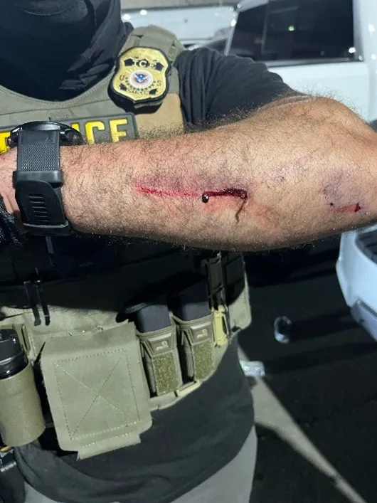 Blood drips down the arm of an federal agent that was wounded by a protester outside Delaney Hall in Newark, NJ, on May 28, 2026.